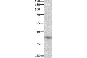 Western blot analysis of Jurkat cell , using DUSP12 Polyclonal Antibody at dilution of 1:500 (DUSP12 抗体)