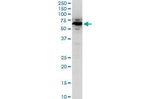 SPTLC2 polyclonal antibody (A01), Lot # 051123JC01. (SPTLC2 抗体  (AA 453-561))