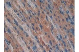 Immunohistochemistry (IHC) image for anti-Growth Factor Receptor-Bound Protein 7 (GRB7) (AA 298-489) antibody (ABIN7439495)