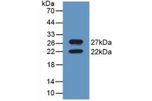 Detection of Recombinant CNX, Mouse using Polyclonal Antibody to Calnexin (CNX) (Calnexin 抗体  (AA 263-482))