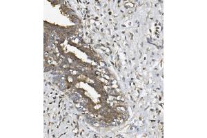 IHC analysis of UNG using anti UNG antibody (ABIN7602695). (UNG 抗体  (AA 96-313))