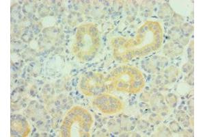 Immunohistochemistry of paraffin-embedded human pancreatic tissue using ABIN7162721 at dilution of 1:100 (PDLIM1 抗体  (AA 1-329))