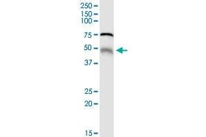 MGRN1 MaxPab rabbit polyclonal antibody. (Mahogunin RING Finger Protein 1 抗体  (AA 1-576))