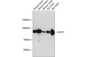 Western blot analysis of extracts of various cell lines, using  Polyclonal Antibody (ABIN6129925, ABIN6136995, ABIN6136996 and ABIN6221112) at 1:1000 dilution. (APLP2 抗体  (AA 340-450))