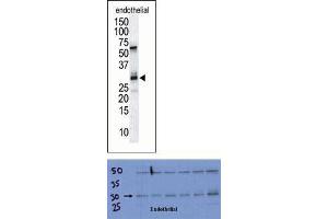 TOP: The anti-DSCR1 Pab is used in Western blot to detect DSCR1 in endothelial tissue lysate. (RCAN1 抗体  (C-Term))