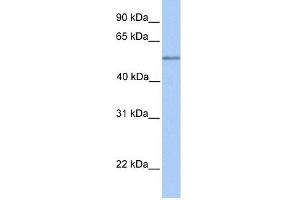 WB Suggested Anti-C17orf74 Antibody Titration: 0. (C17orf74 抗体  (Middle Region))