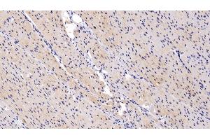 Immunohistochemistry (IHC) image for anti-Angiopoietin-Like 4 (ANGPTL4) (AA 182-388) antibody (ABIN7433018)