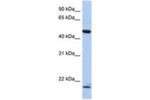 Image no. 1 for anti-Pleiomorphic Adenoma Gene-Like 1 (PLAGL1) (AA 71-120) antibody (ABIN6744331) (PLAGL1 抗体  (AA 71-120))