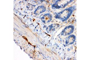 Anti- IRS1 antibody, IHC(P) IHC(P): Rat Intestine Tissue (IRS1 抗体  (AA 1041-1242))