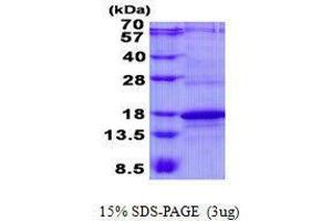 Figure annotation denotes ug of protein loaded and % gel used. (CD247 蛋白)