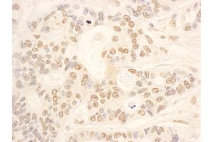 Immunohistochemistry (IHC) image for anti-NOP58 Ribonucleoprotein (NOP58) (AA 479-529) antibody (ABIN7454853)