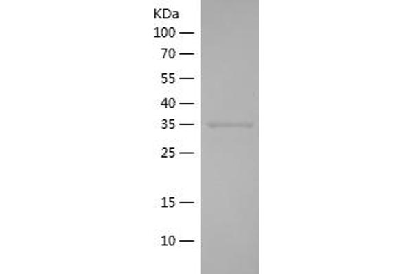 APEX1 Protein (AA 97-195) (His-IF2DI Tag)