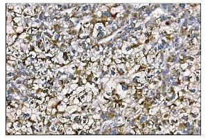 IHC analysis of MERTK using anti-MERTK antibody (ABIN7600623). (MERTK 抗体  (AA 21-489))