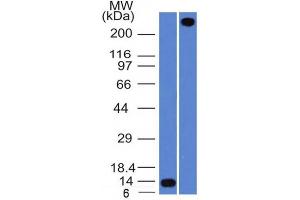 Western Blot Analysis A) Recombinant Protein (B) human lung lysate Using VWF Mouse Monoclonal Antibody (VWF/1465). (VWF 抗体  (AA 1815-1939))