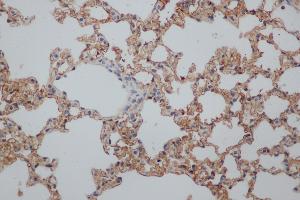 Immunohistochemistry (IHC) image for anti-Natural Killer Cell Receptor 2B4 (CD244) antibody (ABIN5959143) (2B4 抗体)