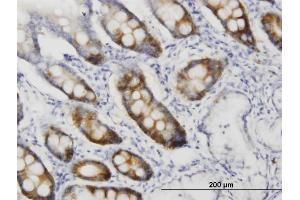 Immunoperoxidase of monoclonal antibody to CDC2 on formalin-fixed paraffin-embedded human small Intestine. (CDK1 抗体  (AA 1-297))