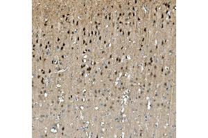 IHC analysis of TORC1/CRTC1 using anti-TORC1/CRTC1 antibody (ABIN7602801).