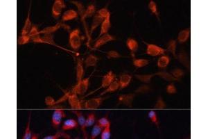 Immunofluorescence analysis of NIH/3T3 cells using SLC25A19 Polyclonal Antibody at dilution of 1:100.