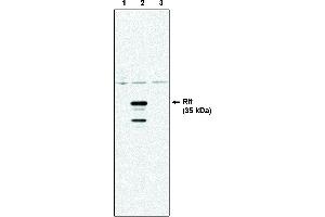 Western blot analysis using Rit antibody . (RIT1 抗体)