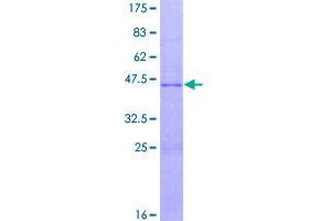 Insulin-Like Growth Factor 1 (IGF1) (AA 1-153) protein (GST tag)