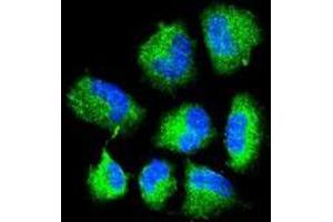 Confocal immunofluorescent analysis of CHAT Antibody (N-term) with NCI-H460 cell followed by Alexa Fluor® 488-conjugated goat anti-rabbit lgG (green). (Choline Acetyltransferase 抗体  (N-Term))