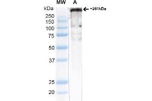 Western Blot analysis of Rat brain membrane lysate (native) showing detection of ~261 kDa Cav3. (CACNA1H 抗体  (AA 1019-1293) (Atto 390))