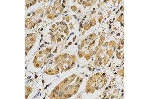 Immunohistochemistry of paraffin-embedded human stomach using PLK1 antibody at dilution of 1:200 (x400 lens) (PLK1 抗体  (AA 304-603))