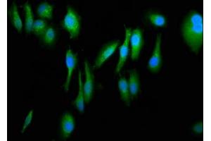 Immunofluorescence staining of Hela cells with ABIN7152698 at 1:266, counter-stained with DAPI. (FERMT1 抗体  (AA 321-420))