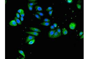 Immunofluorescent analysis of HepG2 cells using ABIN7171115 at dilution of 1:100 and Alexa Fluor 488-congugated AffiniPure Goat Anti-Rabbit IgG(H+L) (SLC18A2 抗体  (AA 463-514))