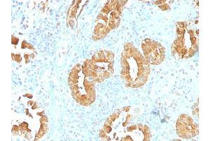 Formalin-fixed, paraffin-embedded human Rectum stained with Villin Monoclonal Antibody (VIL1/1314). (Villin 1 抗体  (AA 179-311))