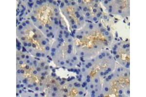 Used in DAB staining on fromalin fixed paraffin- embedded Kidney tissue (FGFR4 抗体  (AA 165-366))