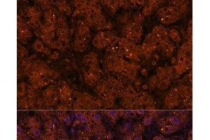 Immunofluorescence (IF) image for anti-3-Hydroxy-3-Methylglutaryl-CoA Synthase 2 (Mitochondrial) (HMGCS2) antibody (ABIN7257752)