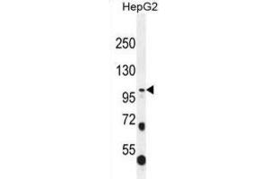 Western Blotting (WB) image for anti-Collagen, Type XXI, alpha 1 (COL21A1) antibody (ABIN2996551) (COL21A1 抗体)