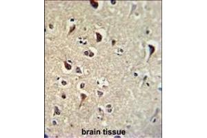 Immunohistochemistry (Paraffin-embedded Sections) (IHC (p)) image for anti-Kruppel-Like Factor 11 (KLF11) (AA 7-36), (N-Term) antibody (ABIN390561)