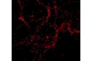 Indirect immunostaining of PFA fixed hippocampus neurons (dilution 1 : 500). (CASKIN1 抗体)