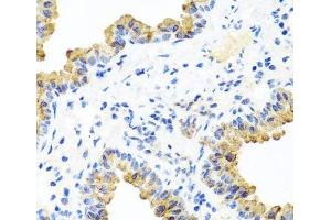 Immunohistochemistry (Paraffin-embedded Sections) (IHC (p)) image for anti-Phosphatidylinositol-5-Phosphate 4-Kinase, Type II, beta (PIP4K2B) antibody (ABIN7264077)