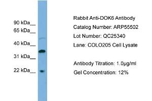 WB Suggested Anti-DOK6  Antibody Titration: 0. (DOK6 抗体  (Middle Region))