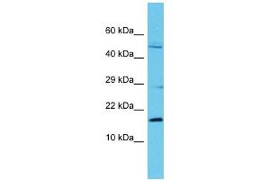 Host: Rabbit Target Name: C8orf44 Sample Type: Fetal Kidney lysates Antibody Dilution: 1. (C8ORF44 抗体  (N-Term))