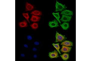ABIN7094814 and ABIN7098865 staining Hela cells by IF/ICC.