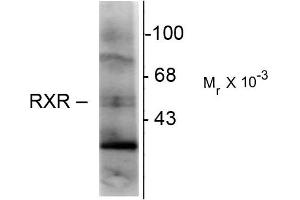 Western blots of hippocampal lysate showing immunolabeling of the ~48k RXR-( isotype. (Retinoid X Receptor gamma 抗体)