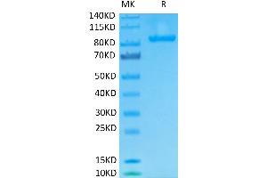 SDS-PAGE (SDS) image for Fibroblast Activation Protein, alpha (FAP) (AA 26-760) protein (His-Avi Tag,Biotin) (ABIN7274585)