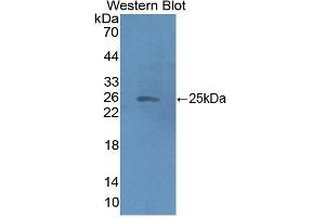 Detection of Recombinant HMGCS2, Human using Polyclonal Antibody to Hydroxymethylglutaryl Coenzyme A Synthase 2, Mitochondrial (HMGCS2) (Hydroxymethylglutaryl Coenzyme A Synthase 2, Mitochondrial (AA 1-167) 抗体)
