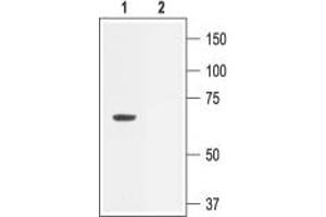 Western Blotting (WB) image for anti-Potassium Intermediate/small Conductance Calcium-Activated Channel, Subfamily N, Member 2 (KCNN2) (AA 542-559), (Intracellular) antibody (ABIN7043461)