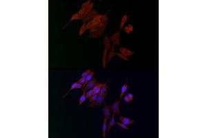 Immunofluorescence analysis of NIH/3T3 cells using  Rabbit pAb (ABIN3016805, ABIN3016806, ABIN3016807 and ABIN6219845) at dilution of 1:100. (ADAMTS5 抗体  (AA 731-930))