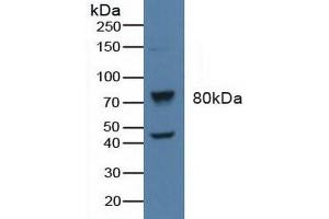 Figure. (beta-Adrenergic Receptor Kinase (AA 398-640) 抗体)