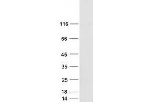 Western Blotting (WB) image for PTPRF Interacting Protein, Binding Protein 1 (Liprin beta 1) (PPFIBP1) (Transcript Variant 1) protein (Myc-DYKDDDDK Tag) (ABIN2729439)