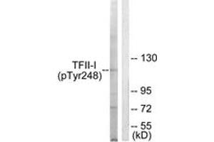 Western blot analysis of extracts from LOVO cells, using TFII-I (Phospho-Tyr248) Antibody. (GTF2I 抗体  (pTyr248))