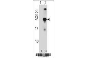 Western blot analysis of SNAP23 using rabbit polyclonal SNAP23 Antibody using 293 cell lysates (2 ug/lane) either nontransfected (Lane 1) or transiently transfected (Lane 2) with the SNAP23 gene. (SNAP23 抗体  (C-Term))