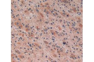 Used in DAB staining on fromalin fixed paraffin- embedded glioma tissue (Reelin 抗体  (AA 26-190))