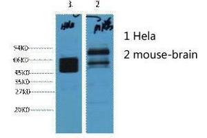 Western Blot (WB) analysis of 1) HeLa, 2) Mouse Brain, diluted at 1:4000. (KRT8 抗体)
